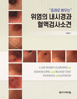 건국대병원 이선영 교수, '위염의 내시경과 혈액검사소견' 출간
