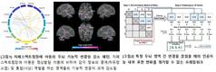 서울대병원-KIST-멜버른대, '자폐 뇌영상 AI'의 생물학적 검증 모델 제시