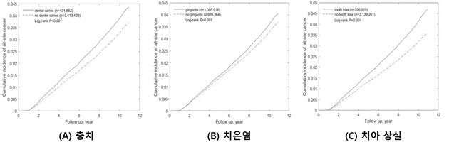 "구강질환 있으면 암 발생 사망률도 높아져… 치아 상실 시 대장암 13%